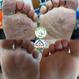 جادو طبیعت سبز خدمات تخصصی رفع جوش و لک و اسکالپ در قم گلزار شهدا 12
