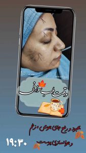جادو طبیعت سبز خدمات تخصصی رفع جوش و لک و اسکالپ در قم گلزار شهدا
