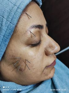 جادو طبیعت سبز خدمات تخصصی رفع جوش و لک و اسکالپ در قم گلزار شهدا 2