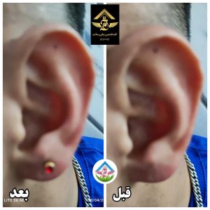 جادو طبیعت سبز خدمات تخصصی رفع جوش و لک و اسکالپ در قم گلزار شهدا 21