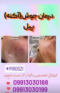 زیبایی دالیا خدمات لیزر و فیلر لب و فیشال در پیروزی 1 1