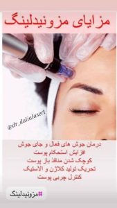 زیبایی دالیا خدمات لیزر و فیلر لب و فیشال در پیروزی 5 1 1