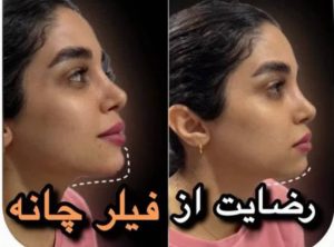 بیوتی لند تزریق چربی ژل بوتاکس لیزر موهای زائد تخلیه چربی در تهران پاسداران 10 2 1 1 1