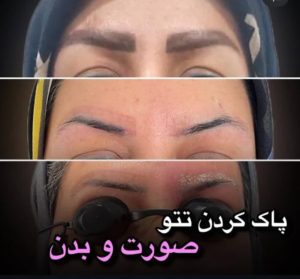بیوتی لند تزریق چربی ژل بوتاکس لیزر موهای زائد تخلیه چربی در تهران پاسداران 11 2 1 1 1