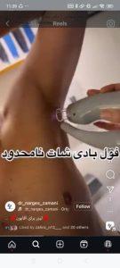 بیوتی لند تزریق چربی ژل بوتاکس لیزر موهای زائد تخلیه چربی در تهران پاسداران 12 2 1 1 1