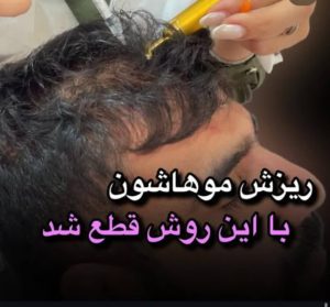 بیوتی لند تزریق چربی ژل بوتاکس لیزر موهای زائد تخلیه چربی در تهران پاسداران 13 2 1 1 1