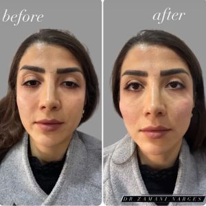 بیوتی لند تزریق چربی ژل بوتاکس لیزر موهای زائد تخلیه چربی در تهران پاسداران 4 2 1 1 1