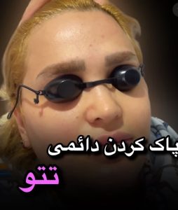 بیوتی لند تزریق چربی ژل بوتاکس لیزر موهای زائد تخلیه چربی در تهران پاسداران 5 2 1 1 1