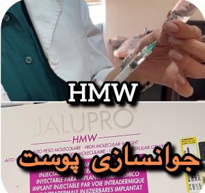 بیوتی لند تزریق چربی ژل بوتاکس لیزر موهای زائد تخلیه چربی در تهران پاسداران 7 2 1 1 1