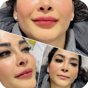 بیوتی لند تزریق چربی ژل بوتاکس لیزر موهای زائد تخلیه چربی در تهران پاسداران 8 2 1 1 1