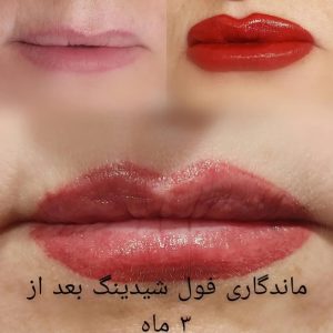 ‏لاغری ‏نیو ‏استایل ‏خدمات ‏‏پلاژن ‏تراپی ‏و هیدرودرمی ‏و ‏کربوکسی ‏تراپی ‏در ‏کارگر ‏جنوبی 7 result
