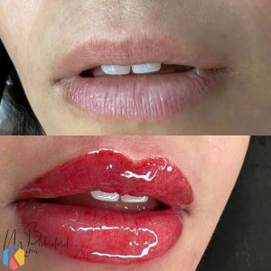 زیبایی مینا بیداری فرد میکروبلیدینگ فیبروز هاشور ابرو در خیابان جمهوری کارگر 9 1024x1024 result