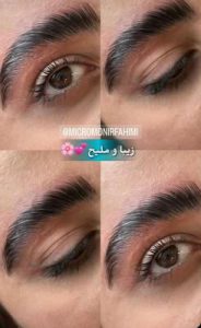 ‏زیبایی ‏فهیمی ‏میکروبلیدینگ ‏تاتو ‏ابرو ‏فیبروز ‏در ‏پیروزی ‏نیروهوایی 10