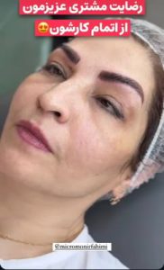 ‏زیبایی ‏فهیمی ‏میکروبلیدینگ ‏تاتو ‏ابرو ‏فیبروز ‏در ‏پیروزی ‏نیروهوایی 15