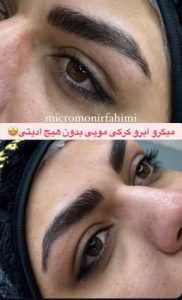 ‏زیبایی ‏فهیمی ‏میکروبلیدینگ ‏تاتو ‏ابرو ‏فیبروز ‏در ‏پیروزی ‏نیروهوایی 16