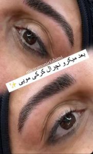 ‏زیبایی ‏فهیمی ‏میکروبلیدینگ ‏تاتو ‏ابرو ‏فیبروز ‏در ‏پیروزی ‏نیروهوایی 2