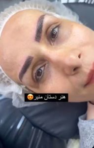 ‏زیبایی ‏فهیمی ‏میکروبلیدینگ ‏تاتو ‏ابرو ‏فیبروز ‏در ‏پیروزی ‏نیروهوایی 3