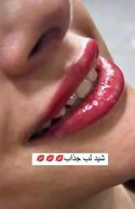 ‏زیبایی ‏فهیمی ‏میکروبلیدینگ ‏تاتو ‏ابرو ‏فیبروز ‏در ‏پیروزی ‏نیروهوایی 6