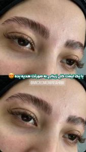 ‏زیبایی ‏فهیمی ‏میکروبلیدینگ ‏تاتو ‏ابرو ‏فیبروز ‏در ‏پیروزی ‏نیروهوایی 8