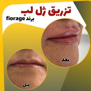 ‏لیلا ‏رئوف ‏پزشک ‏زیبایی ‏و ‏ژل ‏و ‏بوتاکس ‏در ‏بلوار ‏مجد 6