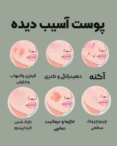 ‏کالین ‏مرکز ‏لیزر ‏و ‏فیشال ‏تخصصی ‏آنزیم ‏تراپی ‏در تهران بلوا ‏مرزداران ‏آیت ‏الله ‏کاشانی
