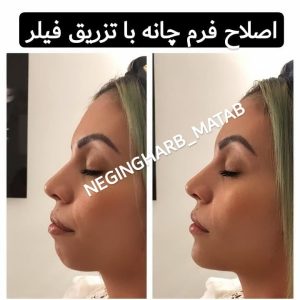 Snapinsta.app 209327767 225869962539470 857801798858515640 n 1080 6