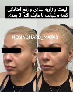 Snapinsta.app 217617160 336670244669508 5476524849782603223 n 1080 6