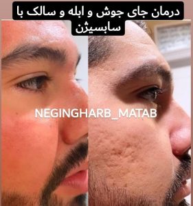 Snapinsta.app 234748225 199498285528650 2019022314638226302 n 1080 6