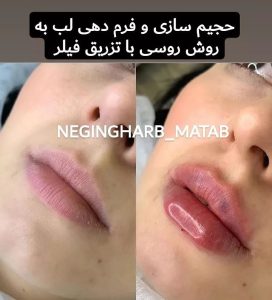 Snapinsta.app 238874043 542766417068727 2630812477375245745 n 1080 1 6