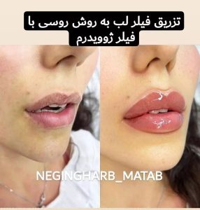 Snapinsta.app 239401686 2163346617164958 6532320063649955254 n 1080 6