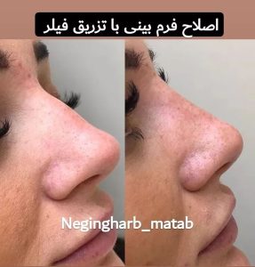 Snapinsta.app 241106977 527406885014810 5150844614218235662 n 1080 6